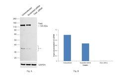 Invitrogen TrkA Recombinant Rabbit Monoclonal Antibody (9F4Y9) 100 &mu;L;
