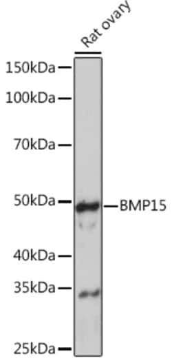 Invitrogen BMP-15 Recombinant Rabbit Monoclonal Antibody (6K5C3) 100 &mu;L;