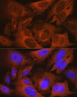 Invitrogen MSMB Recombinant Rabbit Monoclonal Antibody (4L8B5) 100 &mu;L;
