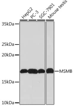 Invitrogen MSMB Recombinant Rabbit Monoclonal Antibody (4L8B5) 100 &mu;L;