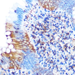 Invitrogen PGAM1 Recombinant Rabbit Monoclonal Antibody (7V9H9) 100 &mu;L;