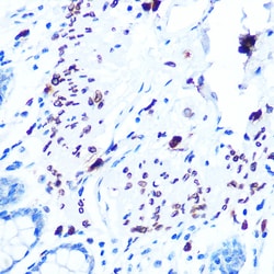 Invitrogen Emerin Recombinant Rabbit Monoclonal Antibody (10Y5K9) 100 &mu;L;