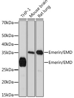 Invitrogen Emerin Recombinant Rabbit Monoclonal Antibody (10Y5K9) 100 &mu;L;