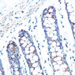 SFRP4 Recombinant Rabbit Monoclonal Antibody (7Z6Q1):Antibodies, Recombinant
