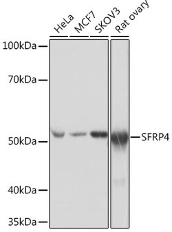 SFRP4 Recombinant Rabbit Monoclonal Antibody (7Z6Q1):Antibodies, Recombinant