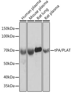 Invitrogen tPA Recombinant Rabbit Monoclonal Antibody (10W4L1) 100 &mu;L;