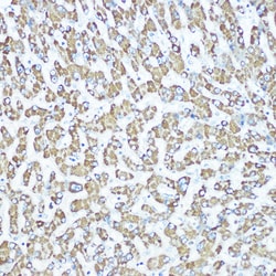 Invitrogen CPS1 Recombinant Rabbit Monoclonal Antibody (1R6W3) 100 &mu;L;