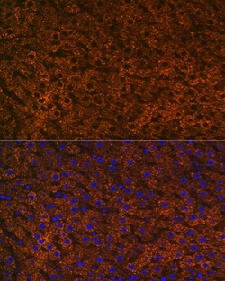 Invitrogen CPS1 Recombinant Rabbit Monoclonal Antibody (1R6W3) 100 &mu;L;