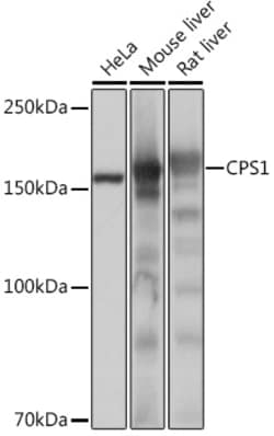 Invitrogen CPS1 Recombinant Rabbit Monoclonal Antibody (1R6W3) 100 &mu;L;