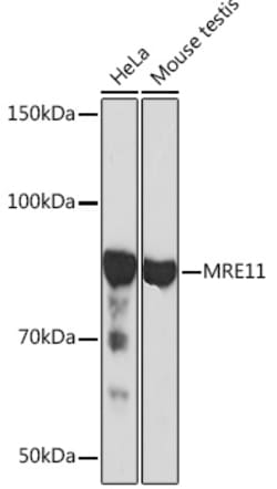MRE11 Recombinant Rabbit Monoclonal Antibody (8Q2B3):Antibodies, Recombinant