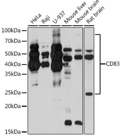 Invitrogen CD83 Recombinant Rabbit Monoclonal Antibody (6K9Q7) 100 &mu;L | Buy Online | Invitrogen&trade; | Fisher Scientific