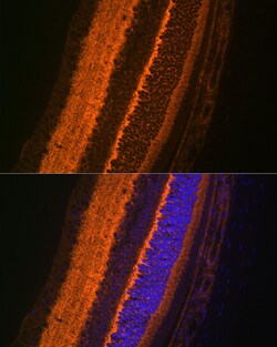 Invitrogen VAMP2 Recombinant Rabbit Monoclonal Antibody (8X9D9) 100 &mu;L;
