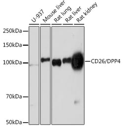 Invitrogen CD26 Recombinant Rabbit Monoclonal Antibody (1T4Y2) 100 &mu;L;