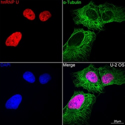 Invitrogen hnRNP U Recombinant Rabbit Monoclonal Antibody (3R3F1) 100 &mu;L;