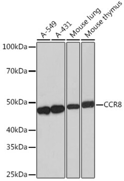 Invitrogen CCR8 Recombinant Rabbit Monoclonal Antibody (9N1Y1) 100 &mu;L | Buy Online | Invitrogen&trade; | Fisher Scientific
