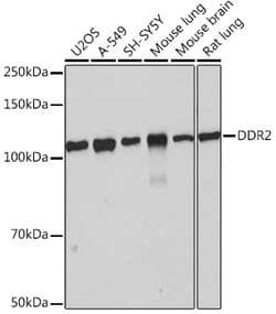 Invitrogen DDR2 Recombinant Rabbit Monoclonal Antibody (1M8U7) 100 &mu;L;