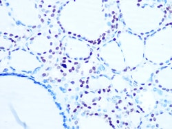Histone H1.0 Recombinant Rabbit Monoclonal Antibody (5E3Q8) 100 &mu;L:Antibodies,
