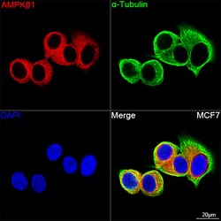 Invitrogen AMPK beta-1 Recombinant Rabbit Monoclonal Antibody (7G8U1) 100