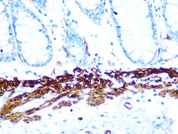 Invitrogen AMPK beta-1 Recombinant Rabbit Monoclonal Antibody (7G8U1) 100