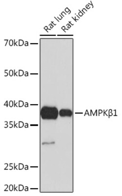 Invitrogen AMPK beta-1 Recombinant Rabbit Monoclonal Antibody (7G8U1) 100
