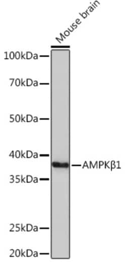 Invitrogen AMPK beta-1 Recombinant Rabbit Monoclonal Antibody (7G8U1) 100
