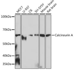 Invitrogen Calcineurin A Recombinant Rabbit Monoclonal Antibody (5I6H8)