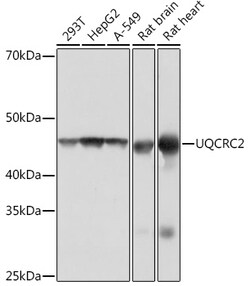 Invitrogen UQCRC2 Recombinant Rabbit Monoclonal Antibody (3E3O8) 100 &mu;L | Buy Online | Invitrogen&trade; | Fisher Scientific
