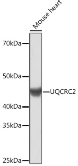 Invitrogen UQCRC2 Recombinant Rabbit Monoclonal Antibody (3E3O8) 100 &mu;L | Buy Online | Invitrogen&trade; | Fisher Scientific