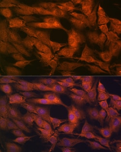 Laminin beta-1 Recombinant Rabbit Monoclonal Antibody (6I9T4) 100 &mu;L:Antibodies,