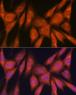 Laminin beta-1 Recombinant Rabbit Monoclonal Antibody (6I9T4) 100 &mu;L:Antibodies,