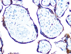 Invitrogen ERp57 Recombinant Rabbit Monoclonal Antibody (9S9X4) 100 &mu;L:Antibodies,
