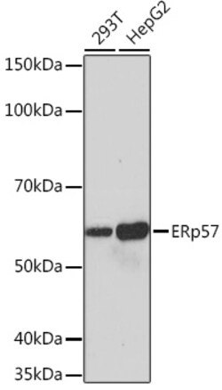 Invitrogen ERp57 Recombinant Rabbit Monoclonal Antibody (9S9X4) 100 &mu;L:Antibodies,