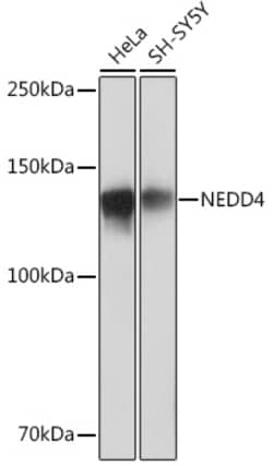 Invitrogen NEDD4 Recombinant Rabbit Monoclonal Antibody (7R0M4) 100 &mu;L:Antibodies,