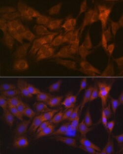 Invitrogen Tetranectin Recombinant Rabbit Monoclonal Antibody (3E5Y7) 100