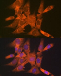 Invitrogen Tetranectin Recombinant Rabbit Monoclonal Antibody (3E5Y7) 100
