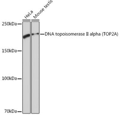 Invitrogen TOP2A Recombinant Rabbit Monoclonal Antibody (8V9C8) 100 &mu;L;