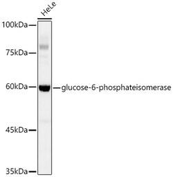 Invitrogen GPI Recombinant Rabbit Monoclonal Antibody (2Y8R0) 100 &mu;L;