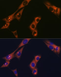Invitrogen alpha Adaptin Recombinant Rabbit Monoclonal Antibody (8R8B6)