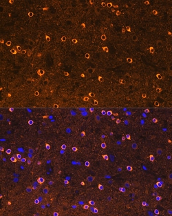 Invitrogen CRMP2 Recombinant Rabbit Monoclonal Antibody (0A1T1) 100 &mu;L;