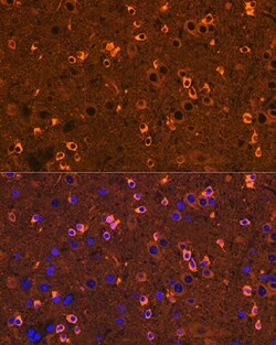 Invitrogen CRMP2 Recombinant Rabbit Monoclonal Antibody (0A1T1) 100 &mu;L;