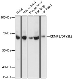 Invitrogen CRMP2 Recombinant Rabbit Monoclonal Antibody (0A1T1) 100 &mu;L;