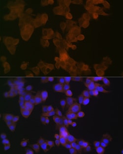 Invitrogen Apolipoprotein L1 Recombinant Rabbit Monoclonal Antibody (1A8N2)