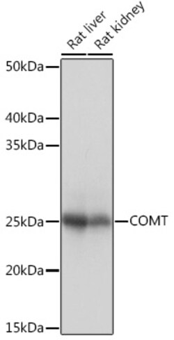 COMT Recombinant Rabbit Monoclonal Antibody (9Y2A3) 100 &mu;L:Antibodies,