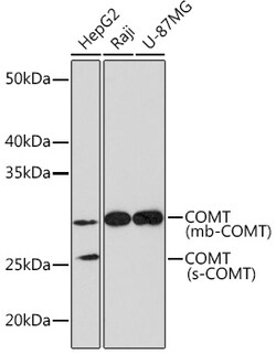 COMT Recombinant Rabbit Monoclonal Antibody (9Y2A3) 100 &mu;L:Antibodies,