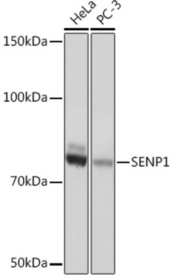 Invitrogen SENP1 Recombinant Rabbit Monoclonal Antibody (1C3I4) 100 &mu;L;