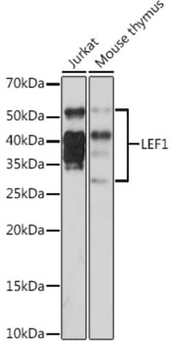 Invitrogen LEF1 Recombinant Rabbit Monoclonal Antibody (9I9T4) 100 &mu;L;