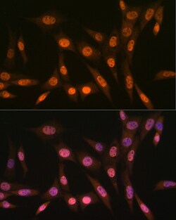 Invitrogen PRMT1 Recombinant Rabbit Monoclonal Antibody (10W10U4) 100 &mu;L:Antibodies,