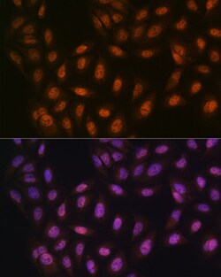 Invitrogen PRMT1 Recombinant Rabbit Monoclonal Antibody (10W10U4) 100 &mu;L:Antibodies,