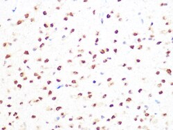 Invitrogen PRMT1 Recombinant Rabbit Monoclonal Antibody (10W10U4) 100 &mu;L:Antibodies,