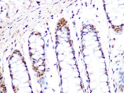 Invitrogen PRMT1 Recombinant Rabbit Monoclonal Antibody (10W10U4) 100 &mu;L:Antibodies,